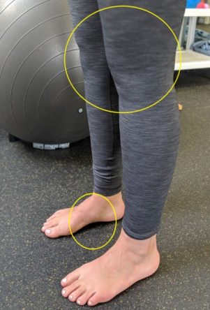 tibialis posterior supporting arch